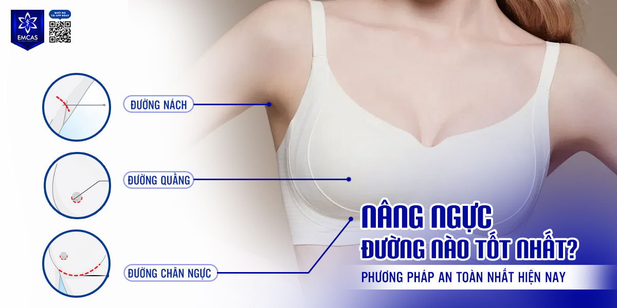 Nâng ngực đường nào tốt nhất? Phương pháp an toàn nhất hiện nay