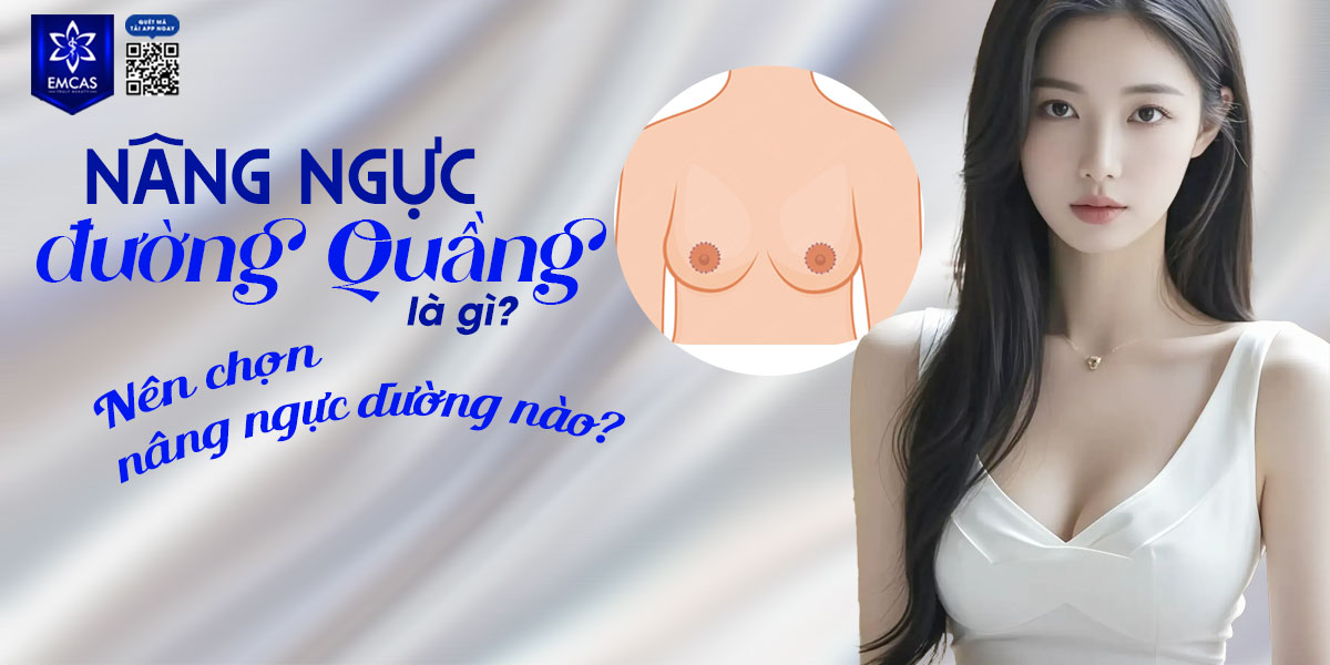 Nâng ngực đường quầng là gì? Nên chọn nâng ngực đường nào?