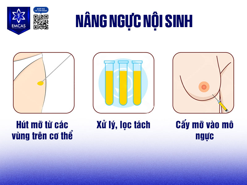 Nâng ngực nội sinh là phương pháp cải thiện kích thước vòng một bằng cách sử dụng chính mỡ tự thân của cơ thể để cấy vào vùng ngực, thay vì đặt túi độn nhân tạo.