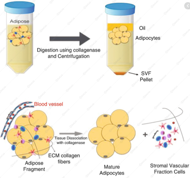 SVF là viết tắt của Stromal Vascular Fragment trong lĩnh vực y học và thẩm mỹ, có nghĩa là các đoạn mạch máu nền.
