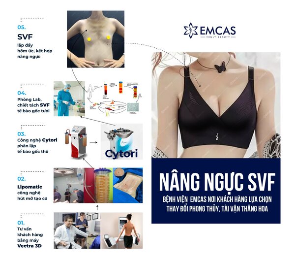 Nâng ngực svf được thực hiện với quy trình chuẩn y khoa tại Bệnh Viện Thẩm Mỹ EMCAS