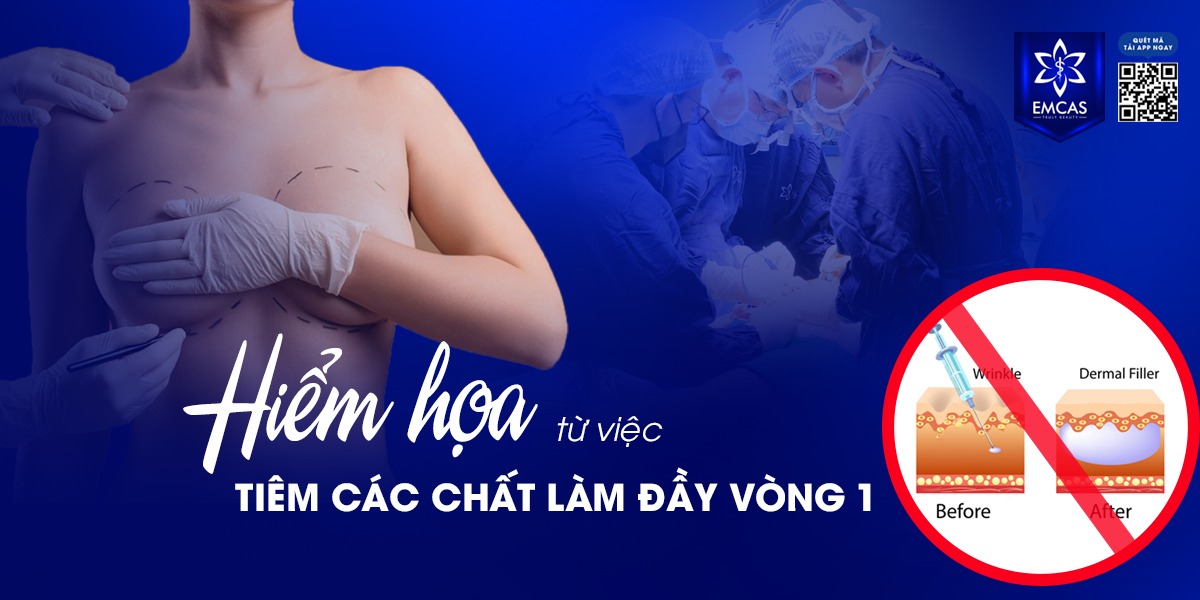 Hiểm Họa Từ Việc Nâng Vú Bằng Chất Làm Đầy