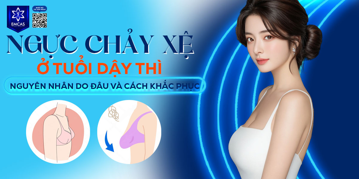 Ngực chảy xệ ở tuổi dậy thì nguyên nhân do đâu và cách khắc phục