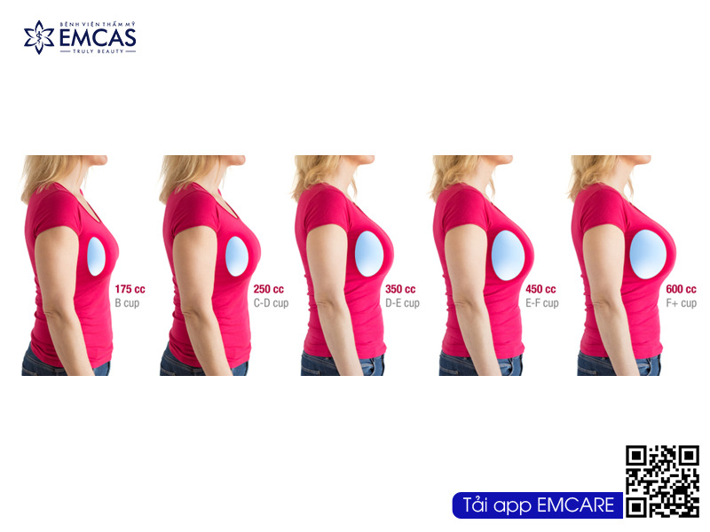 việc chọn size túi quá lớn sẽ gây áp lực lên phần da, cơ ngực, khiến bầu ngực lỏng lẻo, chảy xệ, chùng xuống, dẫn đến tình trạng ngực thông khe