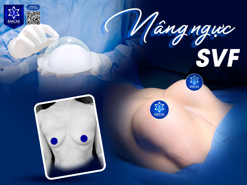 Tại Bệnh Viện Thẩm Mỹ EMCAS, việc điều trị tình trạng ngực không đều không chỉ đơn thuần là “làm to lên” hay “thu nhỏ lại” mà là tái tạo sự cân đối hài hòa với toàn bộ cơ thể.