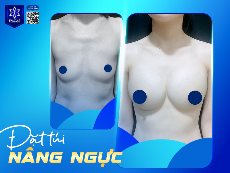 Cơ sở thực hiện là yếu tố quyết định trực tiếp đến mức độ an toàn, khả năng xử lý biến chứng và kết quả thẩm mỹ lâu dài