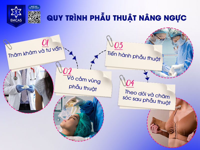 Quy trình phẫu thuật nâng ngực được thực hiện theo từng bước chuẩn y khoa nhằm đảm bảo an toàn, hiệu quả thẩm mỹ và giúp khách hàng đạt được kết quả như mong đợi.