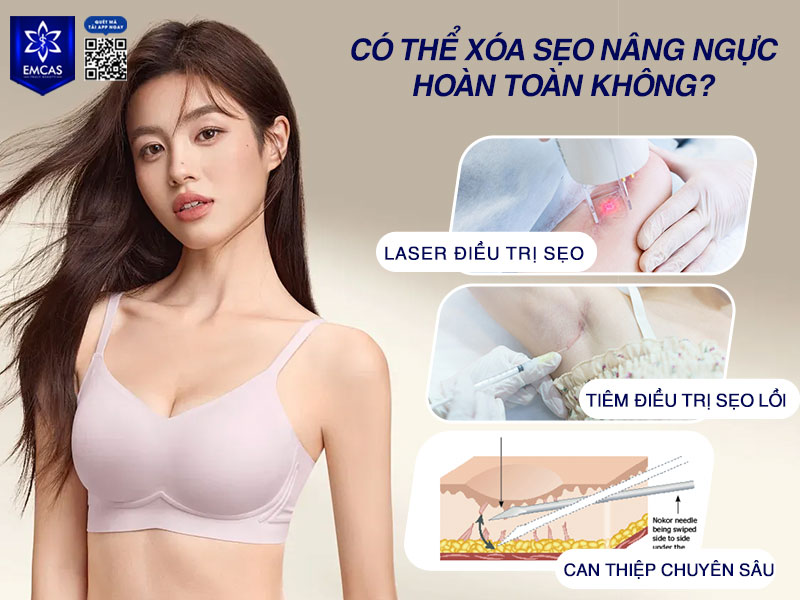 Sẹo nâng ngực không thể xóa hoàn toàn nhưng có thể làm mờ đến mức gần như không thấy, tiệp màu da bằng công nghệ laser, tiêm hoặc điều trị chuyên sâu.