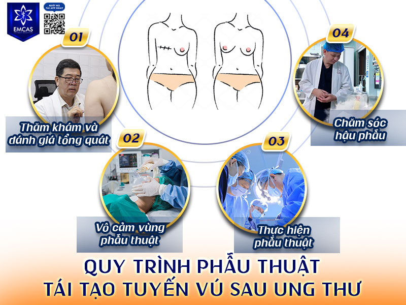 Tại Bệnh Viện Thẩm Mỹ EMCAS, quy trình phẫu thuật tái tạo tuyến vú sau ung thư được xây dựng bài bản và cá nhân hóa cho từng trường hợp nhằm đảm bảo an toàn, hiệu quả.