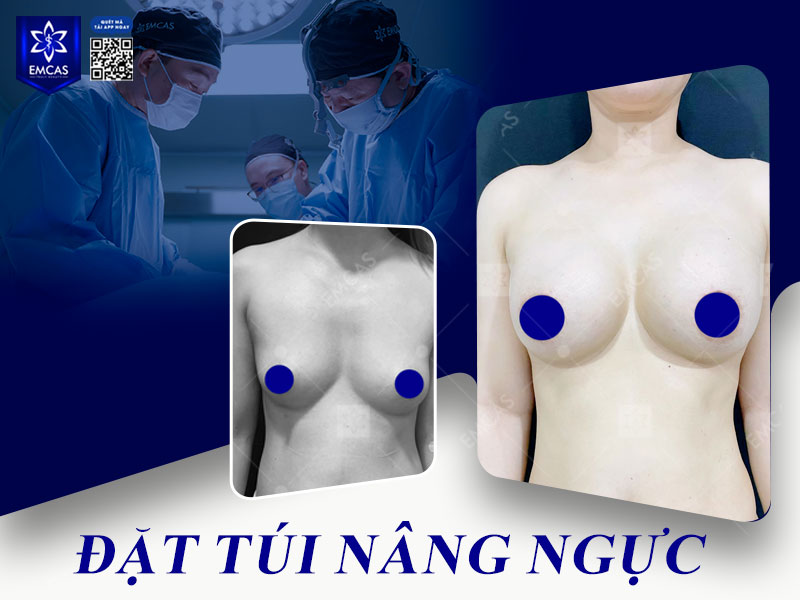 Thay vì tăng cân thiếu kiểm soát, bạn nên đến gặp bác sĩ chuyên khoa để được đánh giá cơ địa, cấu trúc ngực và tư vấn phương pháp tăng vòng 1 phù hợp.