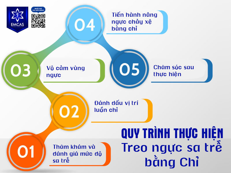 Treo ngực sa trễ bằng chỉ thường được đánh giá là ít xâm lấn, thời gian thực hiện nhanh và không cần phẫu thuật bóc tách mô tuyến vú.