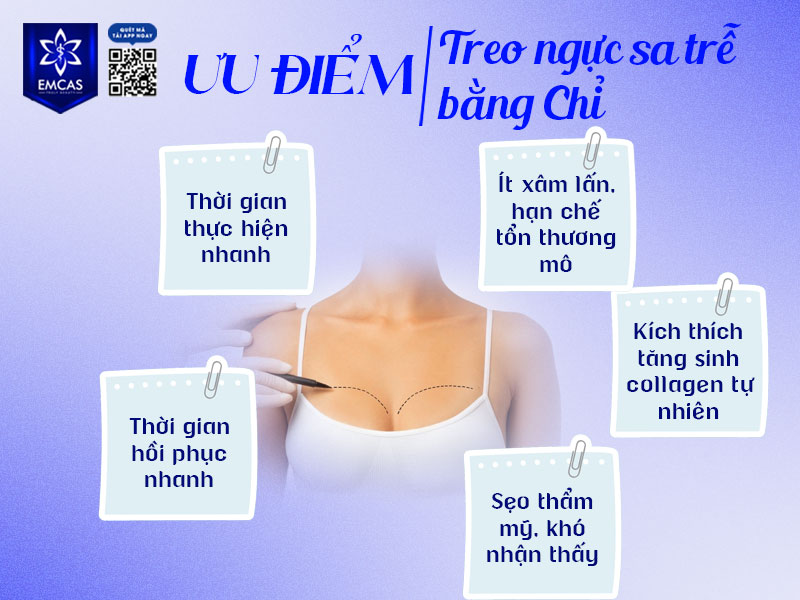 Treo ngực sa trễ bằng chỉ ngày càng được nhiều người quan tâm nhờ đặc điểm ít xâm lấn, thời gian thực hiện nhanh và khả năng cải thiện độ nâng đỡ vòng 1 ở mức độ phù hợp.