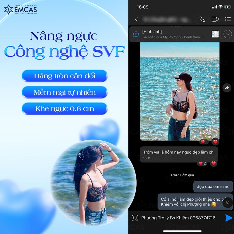  Treo sa trễ được thực hiện đúng kỹ thuật và bởi bác sĩ có tay nghề cao, khả năng cho con bú sẽ không bị ảnh hưởng