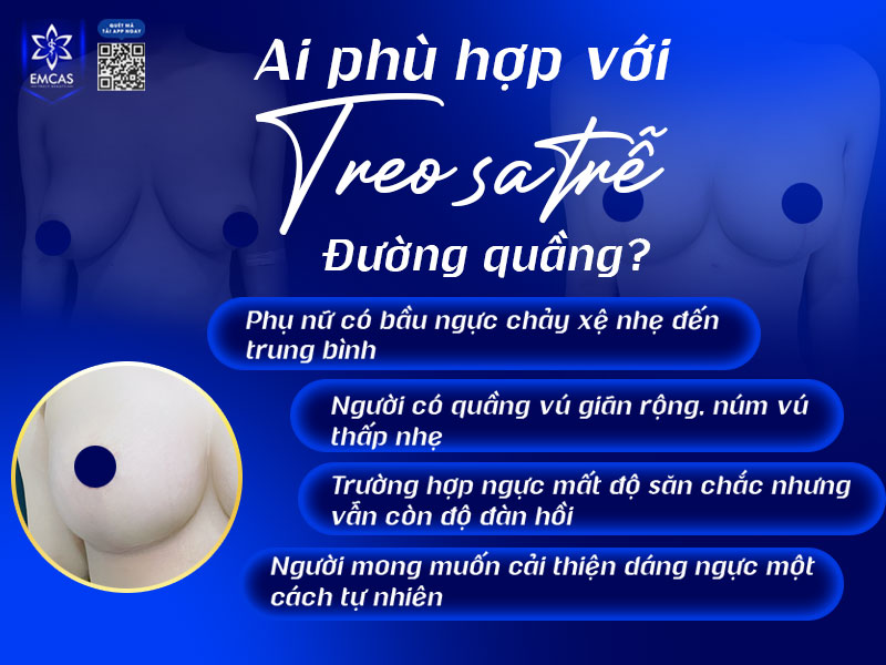 Treo sa trễ quầng vú không áp dụng cho tất cả mọi trường hợp ngực chảy xệ mà chỉ phù hợp với một số đối tượng.