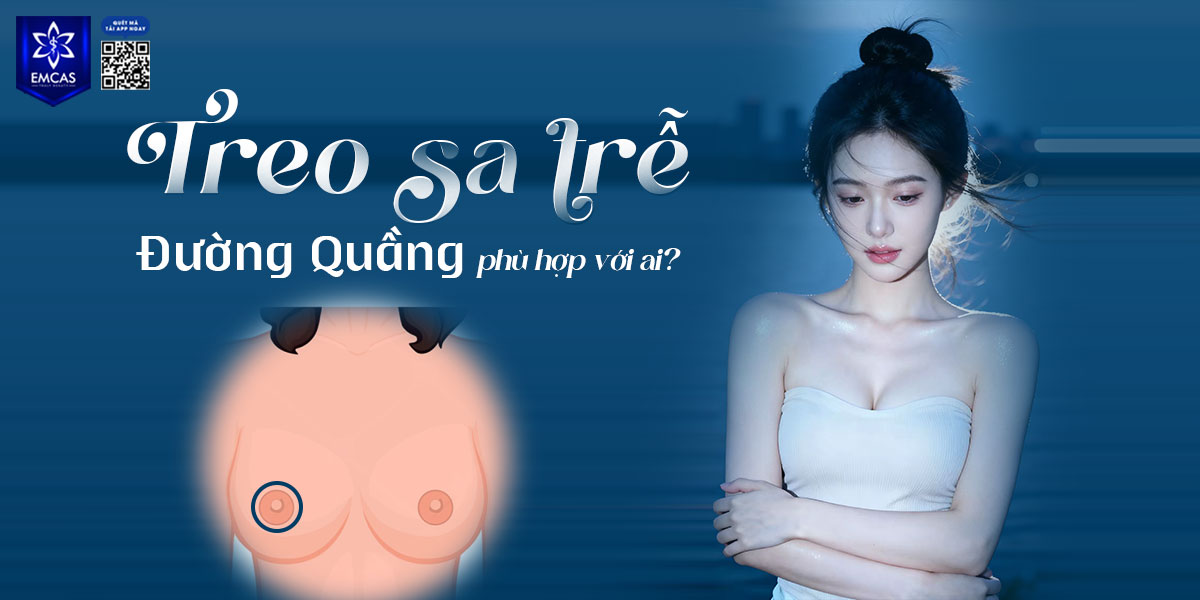 Phẫu thuật treo sa trễ đường quầng phù hợp với ai? Giá bao nhiêu?