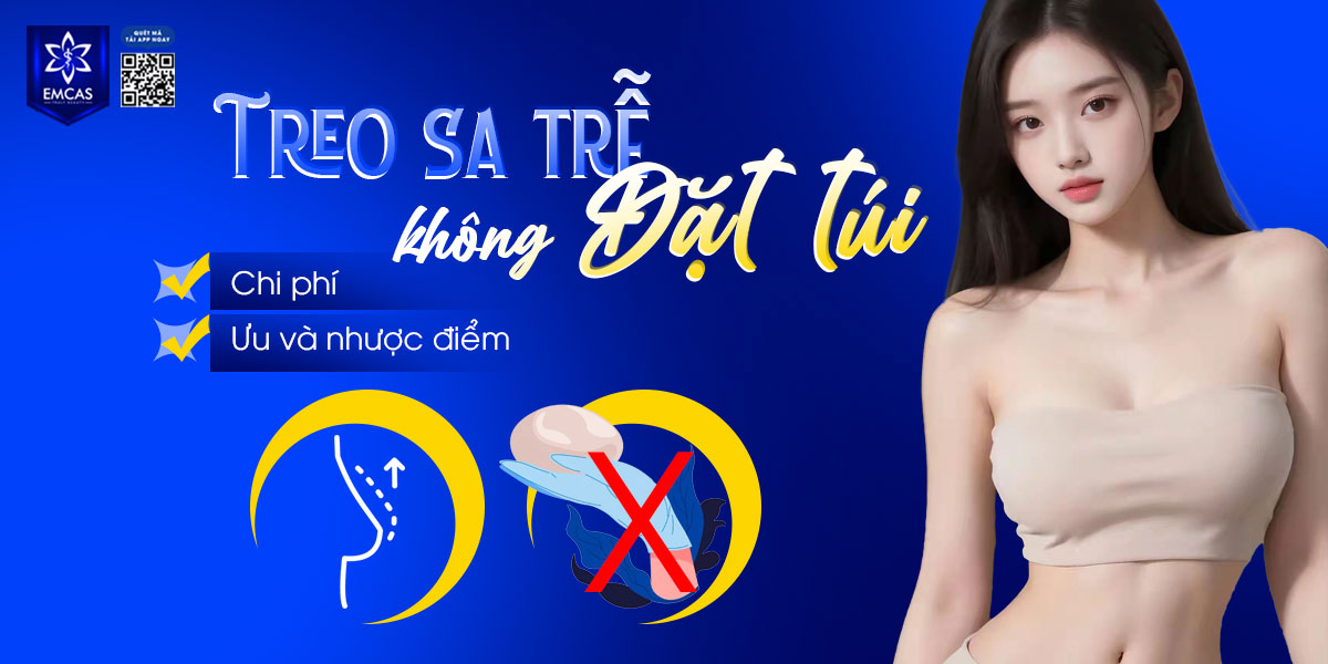 Treo sa trễ không đặt túi giá bao nhiêu? Ưu điểm và nhược điểm