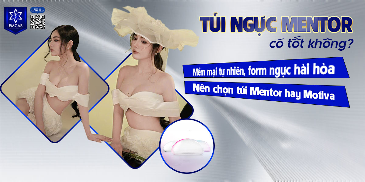 TÚI NGỰC MENTOR CÓ TỐT KHÔNG? NÊN CHỌN TÚI MENTOR HAY MOTIVA