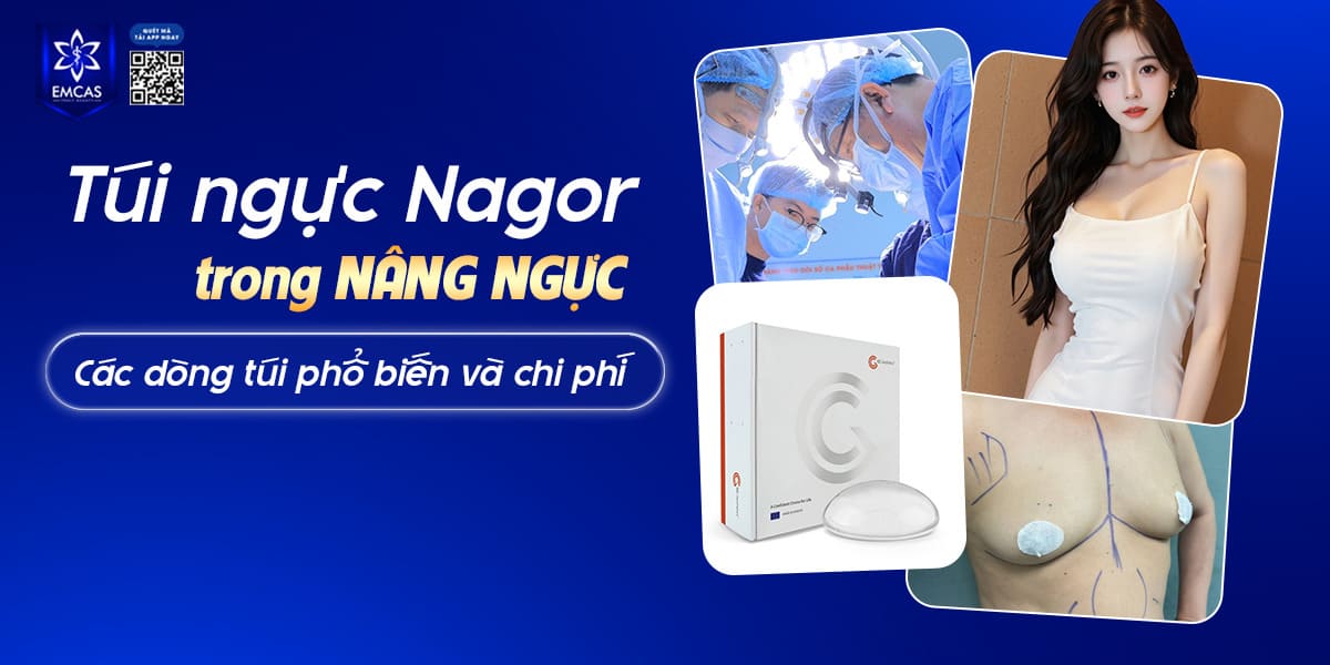 TÚI NGỰC NAGOR CÓ TỐT KHÔNG? CÁC DÒNG TÚI PHỔ BIẾN VÀ CHI PHÍ