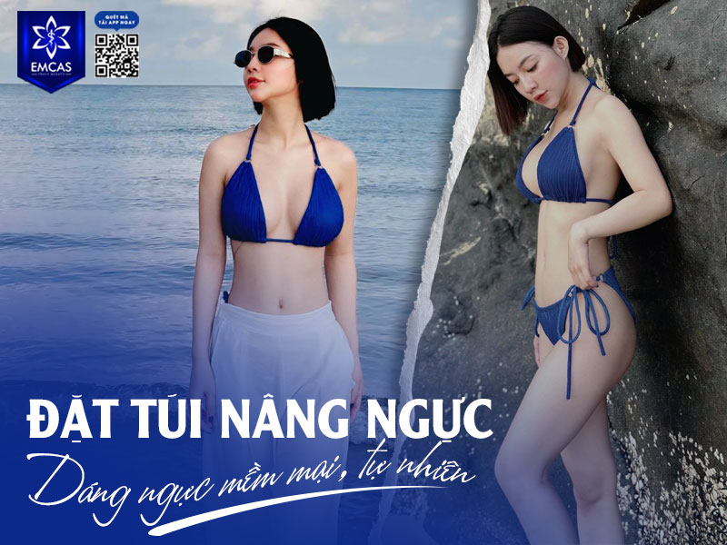 Túi ngực Ergonomix được làm từ silicone cao cấp với cấu trúc linh hoạt, hình dáng túi thay đổi theo tư thế đứng, nằm và vận động.