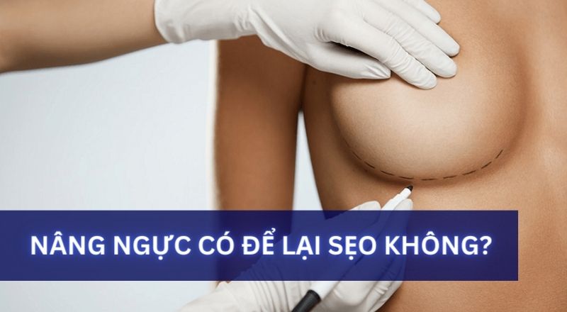 Nâng Ngực Có Để Lại Sẹo Không?