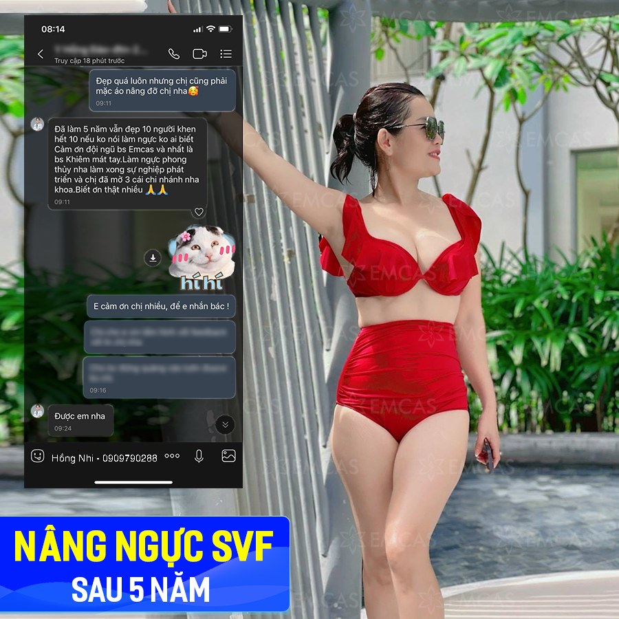 Làm Đẹp Tự Nhiên Với Phương Pháp Nâng Ngực SVF