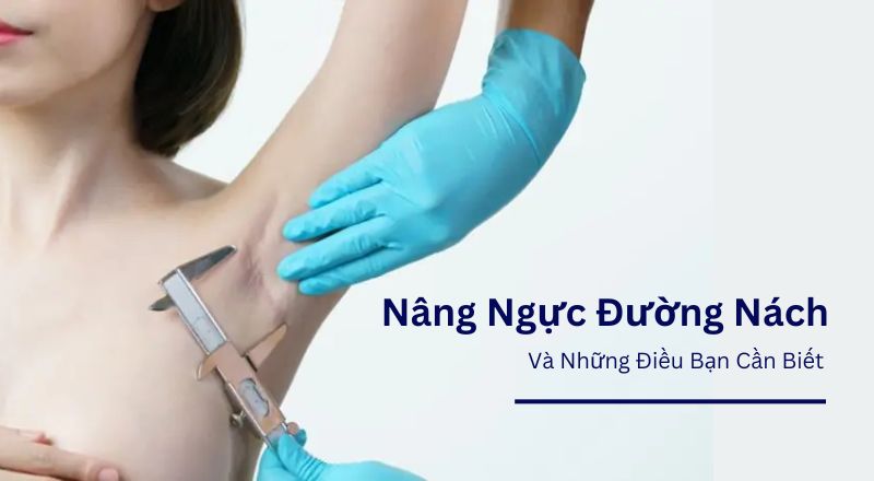 Nâng Ngực Đường Nách Và Những Điều Bạn Cần Biết
