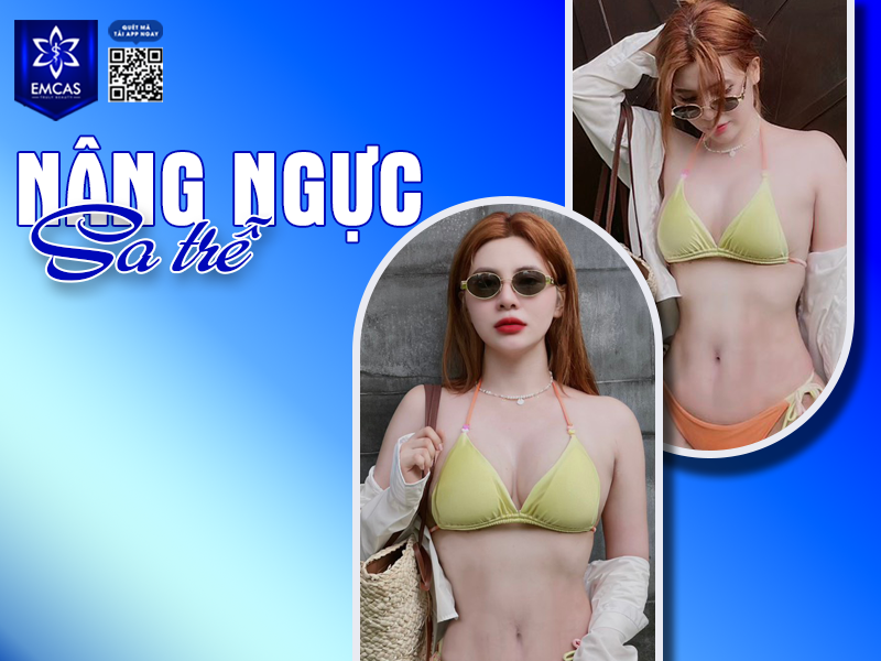 Khắc Phục Ngực Sa Trễ Sau Sinh
