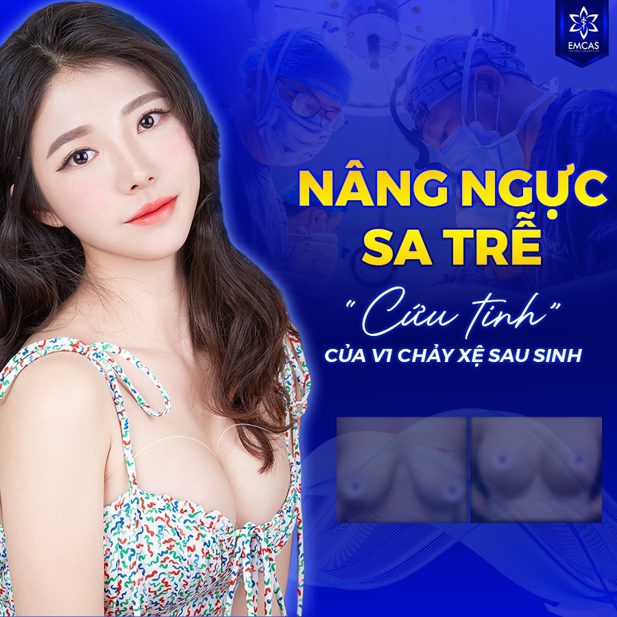 NÂNG NGỰC SA TRỄ ĐỘ 1 - 4