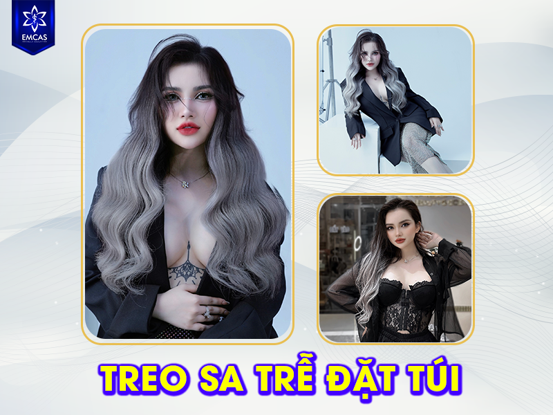 LỢI ÍCH CỦA PHƯƠNG PHÁP NÂNG NGỰC