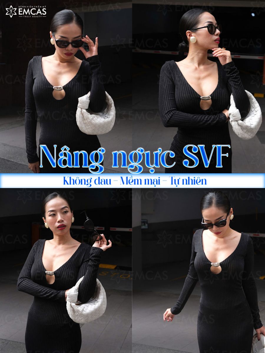 Tại Sao Nâng Ngực SVF Được Các Chị Em Ưa Chuộng?