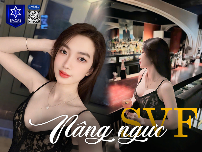 Nâng Ngực SVF - Giải Pháp Cho Vòng 1 Căng Tròn Tự Nhiên