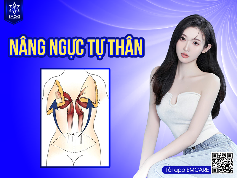 NÂNG NGỰC TỰ THÂN