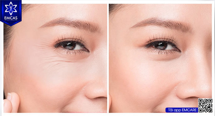 Những Vấn Đề Của Làn Da Và Phương Pháp Điều Trị