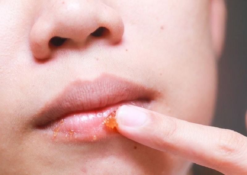 TOP 5 Cách Tẩy Tế Bào Chết Môi Tốt Nhất Cho Môi Căng Mọng