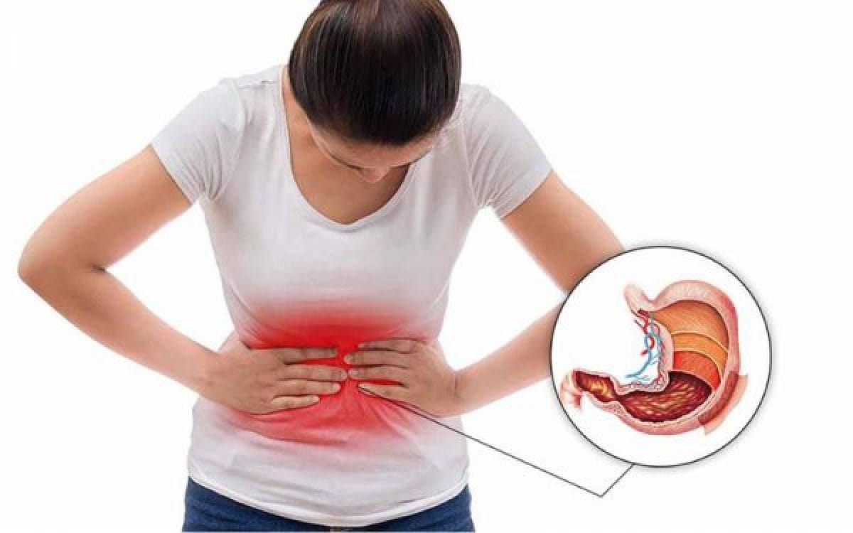 Giải Đáp - Đau Dạ Dày Nên Ăn Gì Để Giảm Cơn Đau Hiệu Quả?