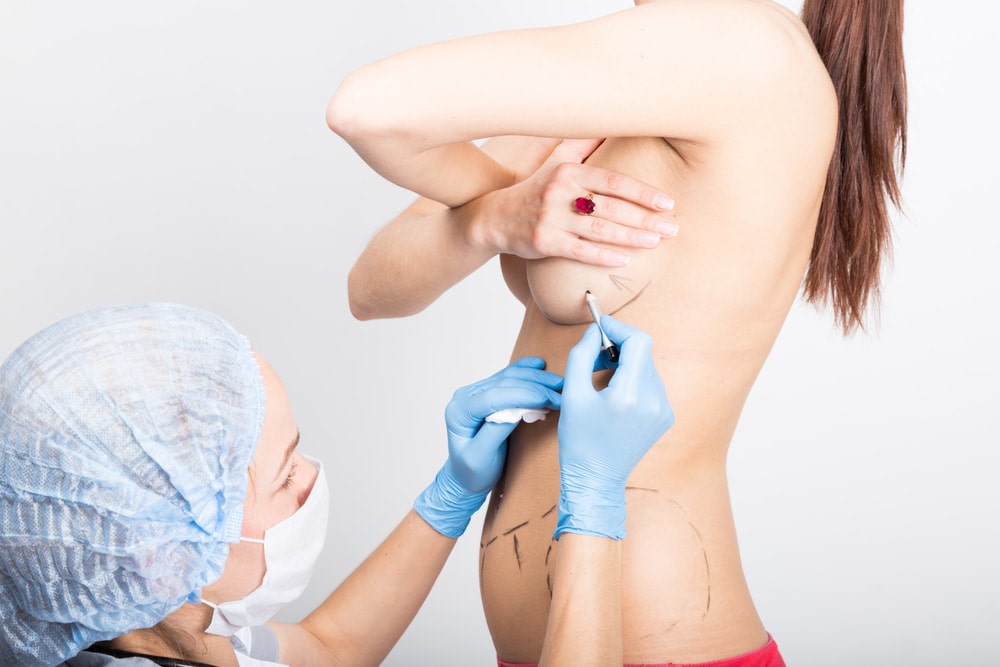 Nâng Ngực Bằng Mỡ Tự Thân Có Ảnh Hưởng Gì Không?