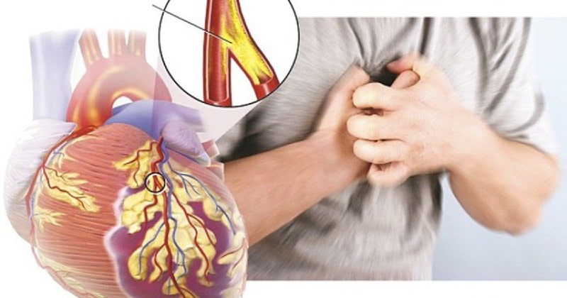Tìm Hiểu Các Nguyên Nhân Khiến Bạn Đau Ở Ngực