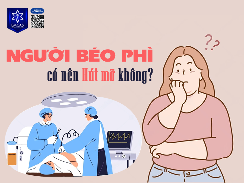 Có Nên Hút Mỡ Để Giảm Cân?