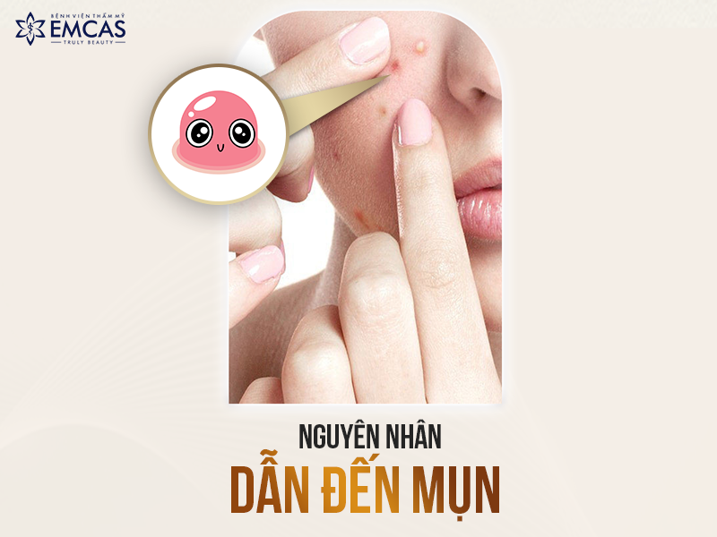 ĐIỀU TRỊ MỤN