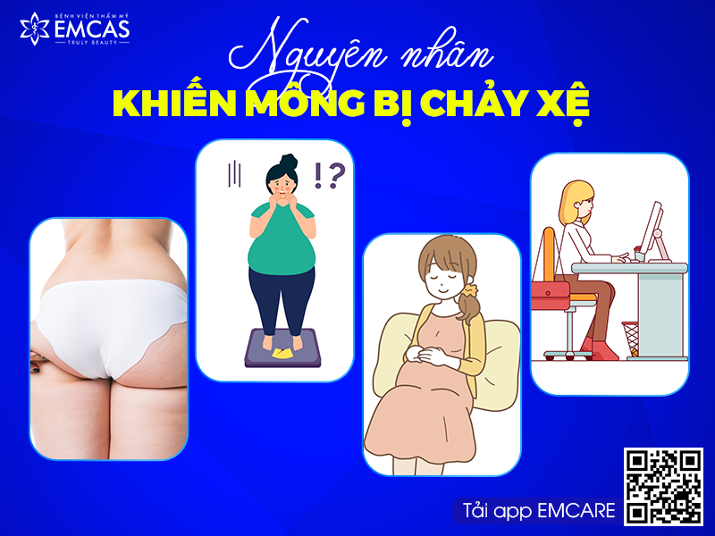 NÂNG MÔNG CHẢY XỆ