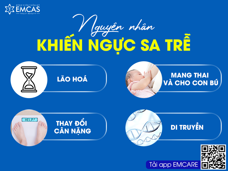 Cấp Độ Sa Trễ Của Ngực Và Kỹ Thuật Khắc Phục