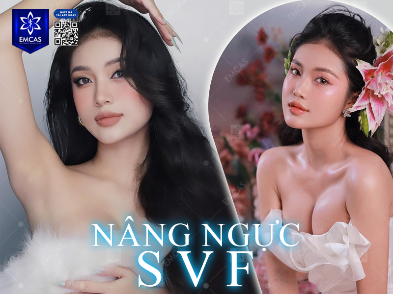Nâng Ngực SVF - Giải Pháp Cho Vòng 1 Căng Tròn Tự Nhiên