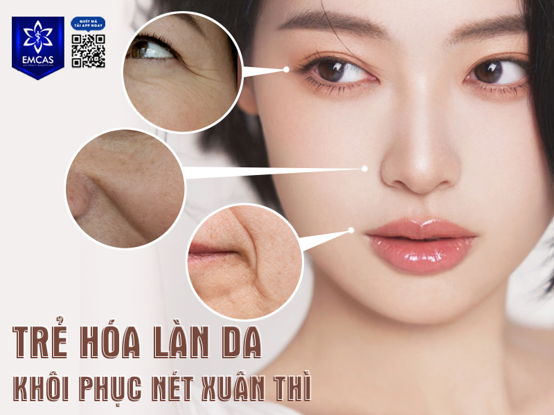 Căng Da Mặt ADM Là Gì? Tất Tần Tật Những Điều Bạn Cần Biết