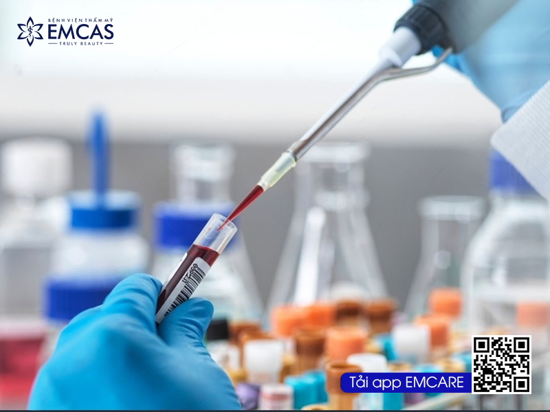 Tầm Quan Trọng Của Việc Kiểm Tra Sức Khỏe Trước Khi Phẫu Thuật Thẩm Mỹ