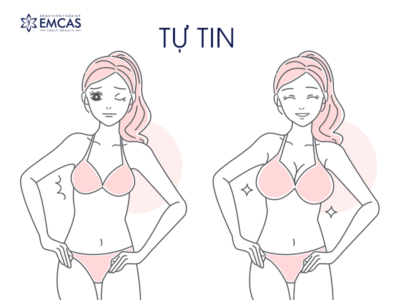 Cảm Giác Sau Nâng Ngực: Những Khía Cạnh Tâm Lý