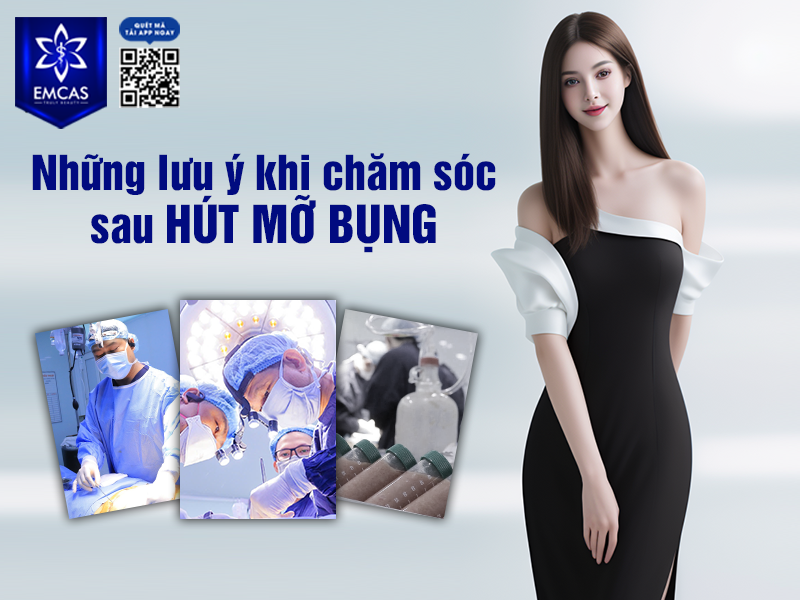 Những Điều Cần Biết Khi Hút Mỡ Bụng