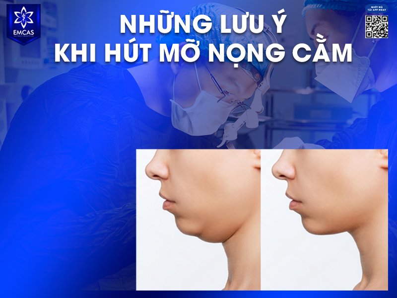 Hút Mỡ Nọng Cằm - Phương Pháp Làm Thon Gọn Khuôn Mặt Nhanh Chóng