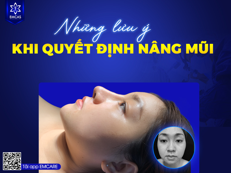 Những Suy Nghĩ Sai Lầm Về Nâng Mũi Có Thể Bạn Chưa Biết