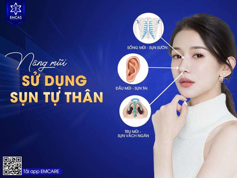 Những Suy Nghĩ Sai Lầm Về Nâng Mũi Có Thể Bạn Chưa Biết