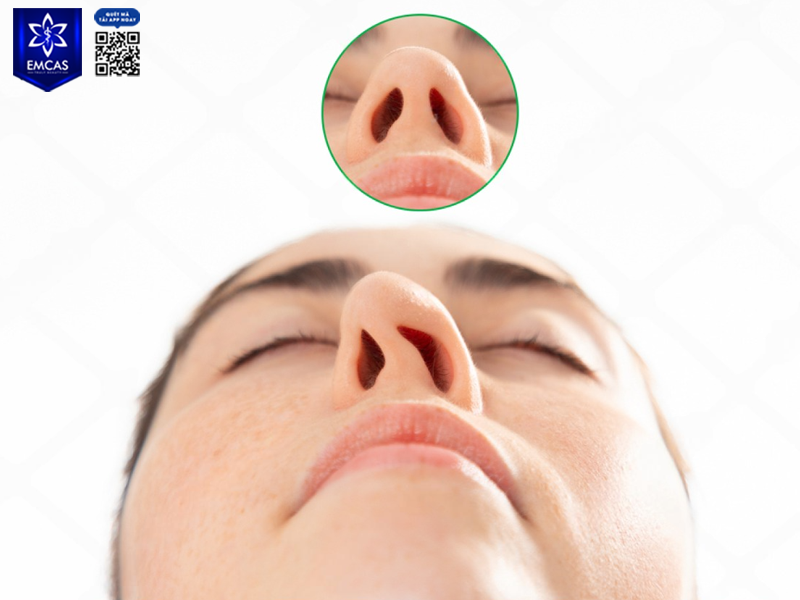 Lựa Chọn Nào Cho Người Nâng Mũi Lần 2?
